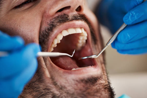 Best Tooth Infection Emergency Dentist  in Bradner, OH