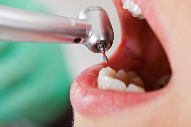 Best Emergency Gum Pain Relief  in Bradner, OH